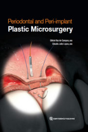 Periodontal and Peri-implant Plastic Microsurgery: Minimally Invasive Techniques with Maximum Precision