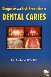 Diagnosis and Risk Prediction of Dental Caries, Volume 2