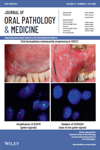 Journal of Oral Pathology & Medicine