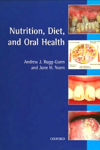 Nutrition Diet and Oral Health (Oxford Medical Publications)