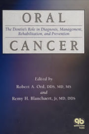 Oral Cancer: The Dentist’s Role in Diagnosis, Management, Rehabilitation and Prevention