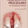 Simplified Regenerative Procedures for Intraosseous Defects