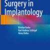 Guided Surgery in Implantology