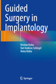 Guided Surgery in Implantology