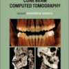 Interpretation Basics of Cone Beam Computed Tomography, 2nd Edition