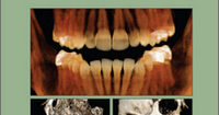 Interpretation Basics of Cone Beam Computed Tomography, 2nd Edition