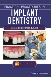 Practical Procedures in Implant Dentistry