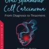 Oral Squamous Cell Carcinoma: From Diagnosis to Treatment