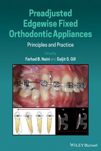 Preadjusted Edgewise Fixed Orthodontic Appliances: Principles and Practice