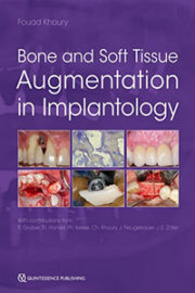 Bone and Soft Tissue Augmentation in Implantology