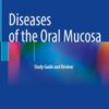 Diseases of the Oral Mucosa: Study Guide and Review