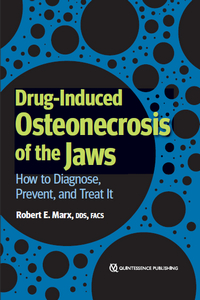 Drug-Induced Osteonecrosis of the Jaws: How to Diagnose, Prevent, and Treat It