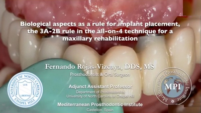 Biological Aspects as a Rule for Implant Placement