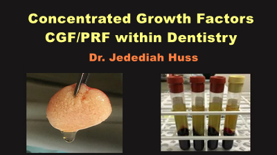 Concentrated Growth Factors: CGF/PRF within Dentistry
