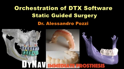 Orchestration of DTX Software: Static Guided Surgery