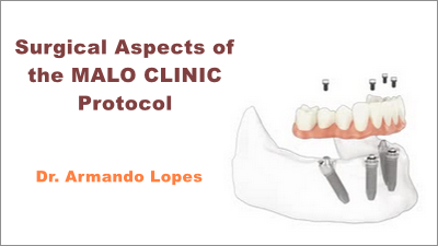 Surgical Aspects of the MALO CLINIC Protocol: From Standard to Zygoma Cases