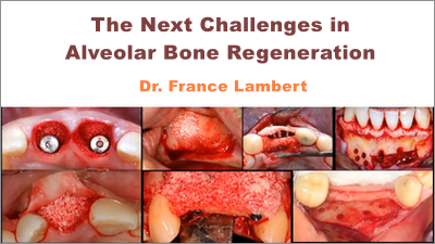The Next Challenges in Alveolar Bone Regeneration