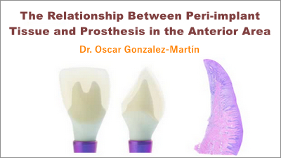 The Relationship Between Peri-implant Tissue and Prosthesis in the Anterior Area