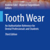 Tooth Wear: An Authoritative Reference for Dental Professionals and Students, 3rd Edition