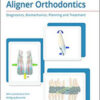 Aligner Orthodontics: Diagnostics, Biomechanics, Planning, and Treatment