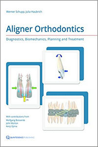 Aligner Orthodontics: Diagnostics, Biomechanics, Planning, and Treatment