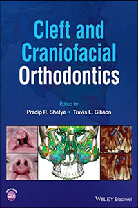 Cleft and Craniofacial Orthodontics