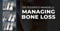 Managing Bone Loss (2 Lectures)