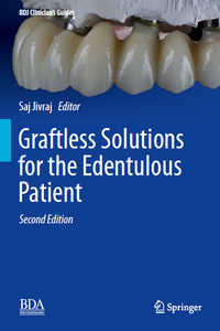 Graftless Solutions for the Edentulous Patient, 2nd Edition