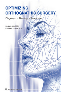 Optimizing Orthognathic Surgery: Diagnosis, Planning, Procedures