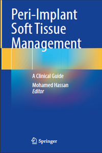 Peri-Implant Soft Tissue Management: A Clinical Guide