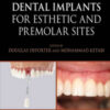 Immediate Dental Implants for Esthetic and Premolar Sites