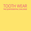 Tooth Wear The Quintessential Challenge