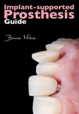 Implant-Supported Prosthesis Guide