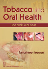 Tobacco and Oral Health: Text and Color Atlas