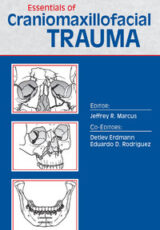 Essentials of Craniomaxillofacial Trauma