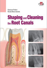 Shaping and Cleaning the Root Canals