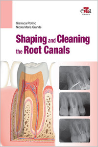 Shaping and Cleaning the Root Canals