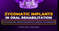 Zygomatic Implants in Oral Rehabilitation: For surgeons, prosthodontists, dental technicians