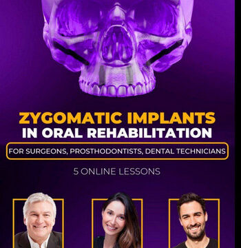 Zygomatic Implants in Oral Rehabilitation: For surgeons, prosthodontists, dental technicians