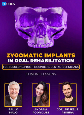 Zygomatic Implants in Oral Rehabilitation: For surgeons, prosthodontists, dental technicians